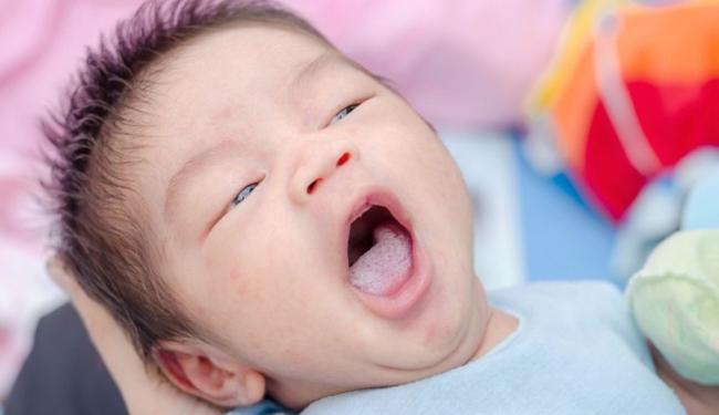 5 cách làm sạch lưỡi bị trắng cho trẻ sơ sinh an toàn, khoa học