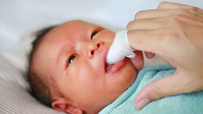 cách chữa trắng lưỡi cho trẻ sơ sinh