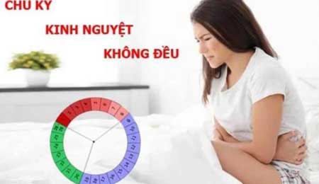 Làm thế nào để kinh nguyệt đều trở lại? Lời khuyên chuyên gia