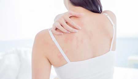 Bật mí mẹo chữa dị ứng thời tiết tại nhà an toàn, hiệu quả