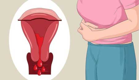 Tổng hợp mẹo chữa kinh nguyệt ra nhiều tại nhà cực hiệu quả